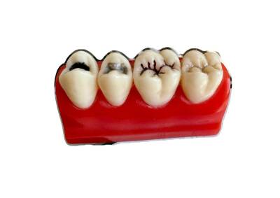 Fantom Yarım Model Diş - Perimel Dental