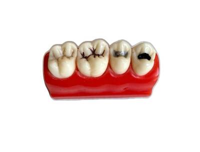 Fantom Yarım Model Diş - 2