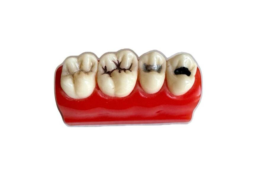 Fantom Yarım Model Diş - 2