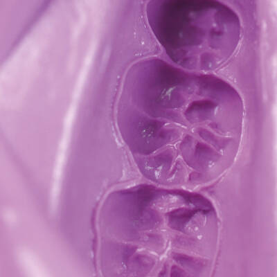  Hydrogum 5 Extra Fast Aljinat 453gr. - 3