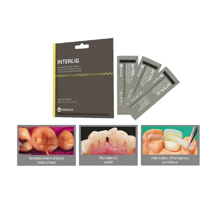 Interlig Fiber Splint Sistemi 3'lü - 3
