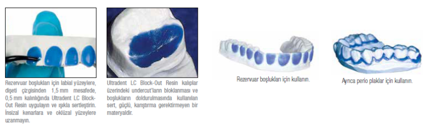 LC Block-Out Resin Şırınga - 2