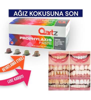 Qartz Prophylaxis Diş Temizleme ve Parlatma Pastası Asorti 200'lü - 3